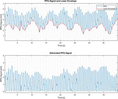 Morphological features of the photoplethysmographic signal: a new approach to characterize the microcirculatory response to photobiomodulation